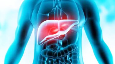 Liver Damage signs