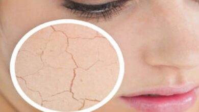 dry skin care