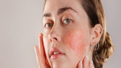 Skin Home Remedy