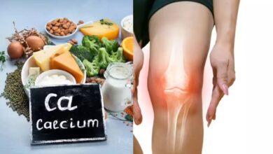 Foods for Bone Healing
