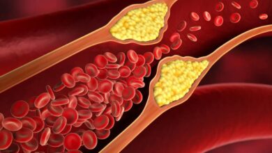 how to reduce cholesterol naturally