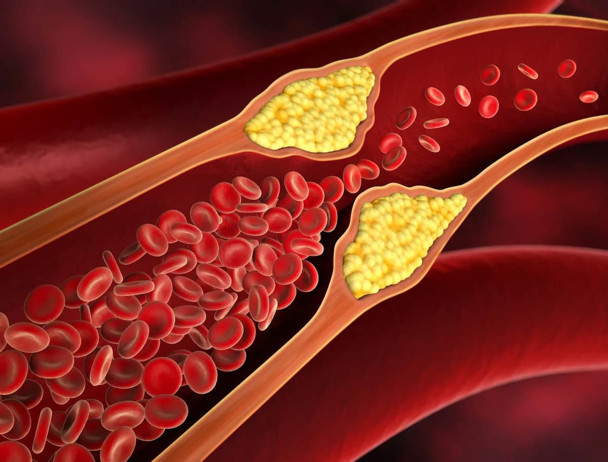 how to reduce cholesterol naturally