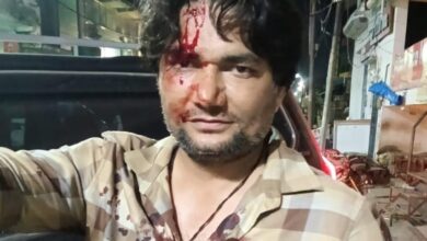 डिवाइडर से टकराई स्कॉर्पियो: बैंककर्मी घायल