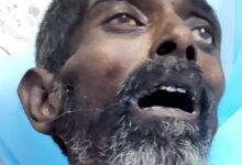 इलाज को अस्पताल पहुंचे अज्ञात व्यक्ति की मौत