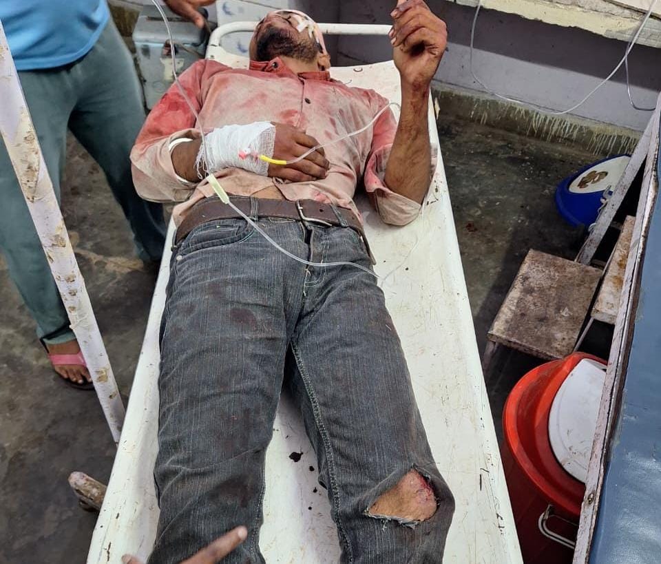 ट्रैक्टर-ट्रॉली की टक्कर से बाइक सवार घायल