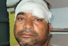 भंडारे में खाना परोस रहे युवक को पीटा: घायल