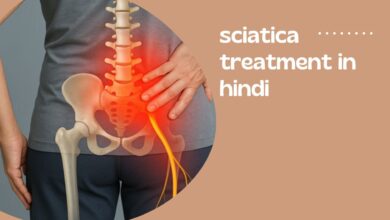 sciatica treatment exercises