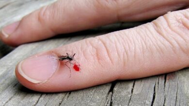 mosquito bites