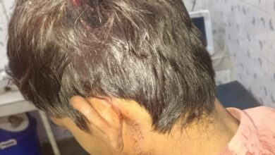 खेलते समय नाबालिक बच्चे का सिर फाड़ा