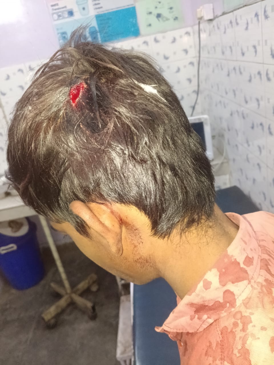 खेलते समय नाबालिक बच्चे का सिर फाड़ा