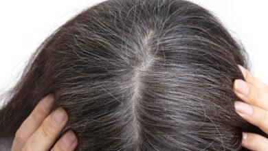 White Hair Causes