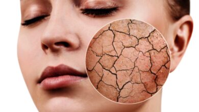 Winter Skin care tips