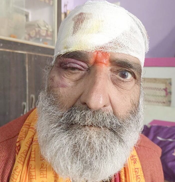 भरथना, इटावा, राष्ट्रीय राजमार्ग-91ए, चौड़ीकरण, सड़क किनारे गढ़े विद्युत पोल, वाहनस्वामी, राहगीर