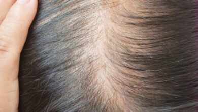 how to get rid of hair fall