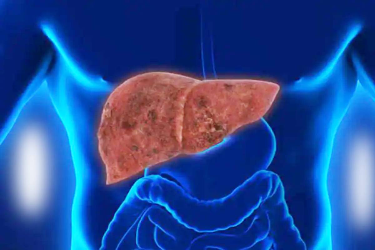 Liver Damaging Habits