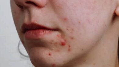 Skin Care Tips