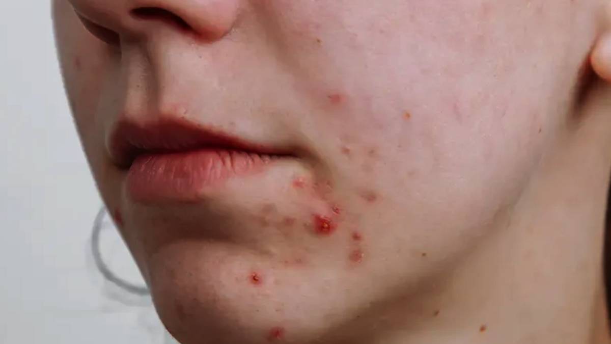 Skin Care Tips