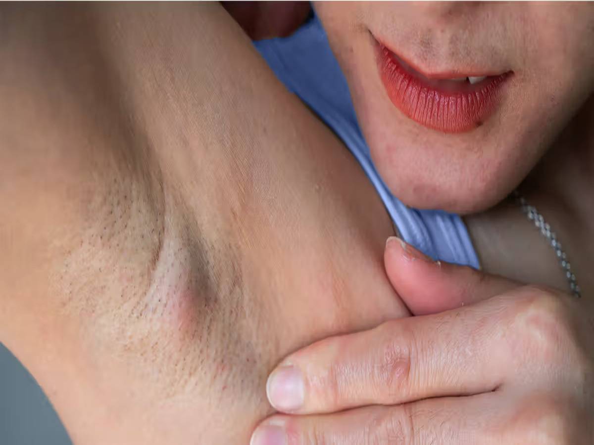 Dark Underarms Treatment 2026