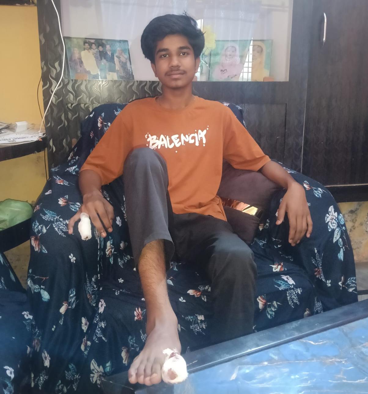 सभासद पुत्र पर पालतू कुत्ते का हमला, पैर में काटा मोहल्ले में दहशत