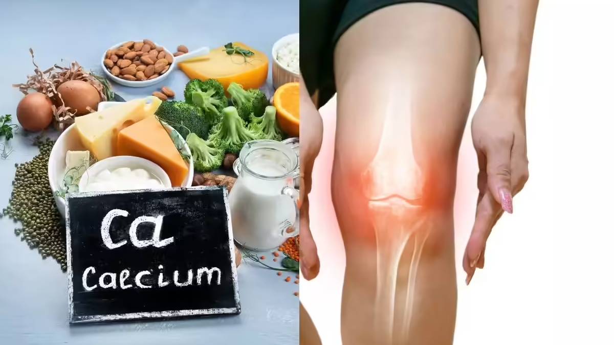 Foods for Bone Healing