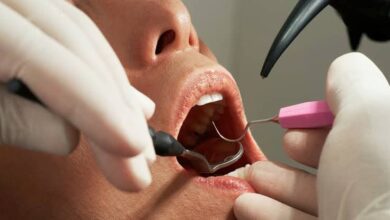 Dental Care Myths