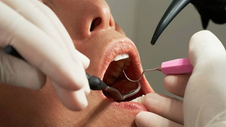 Dental Care Myths