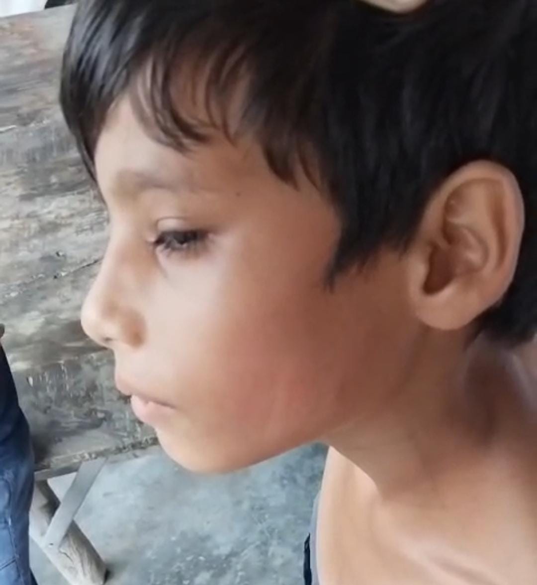 चपरासी ने नावालिग छात्र को बेरहमी से पीटा