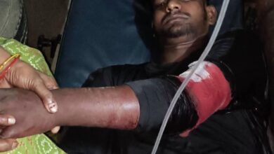 रंजिश में भिड़े दो पक्ष: फायरिंग में युवक घायल
