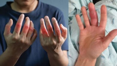 Swollen Hands Causes in Hindi