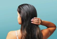 Oily Hair Remedies