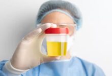 Foamy Urine Causes