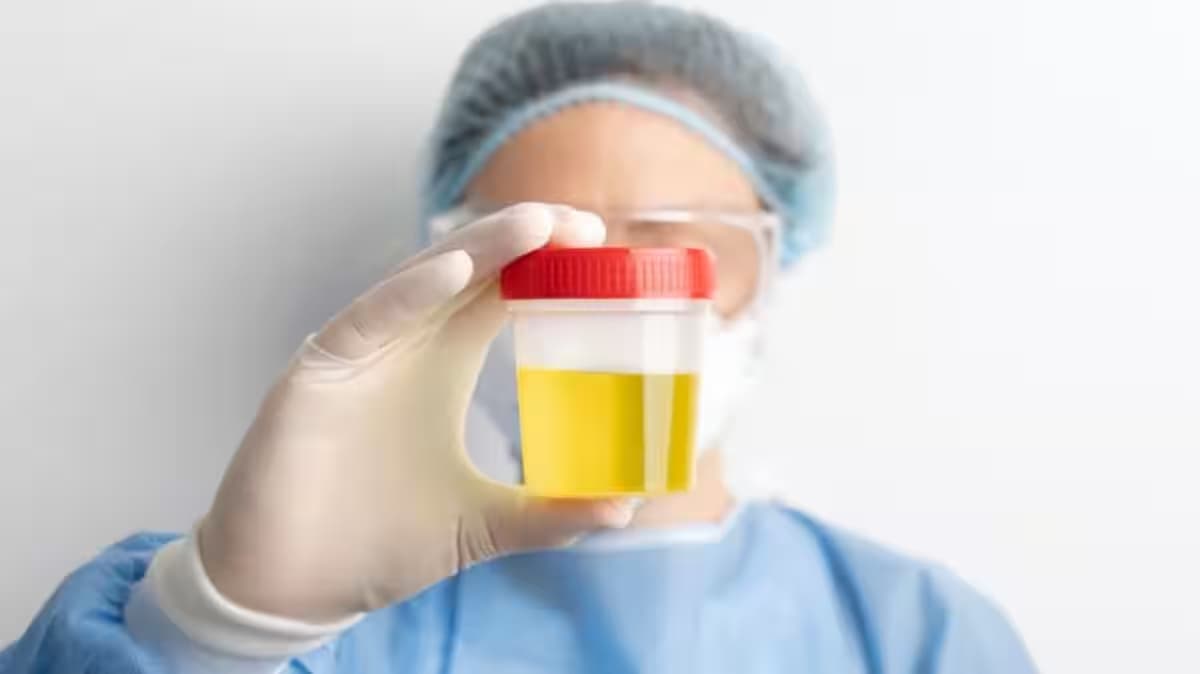Foamy Urine Causes